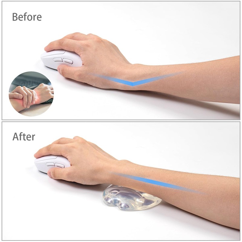 White Gel Mouse Wrist Rest–Clear Cute Fish Mouse Wrist Rest,