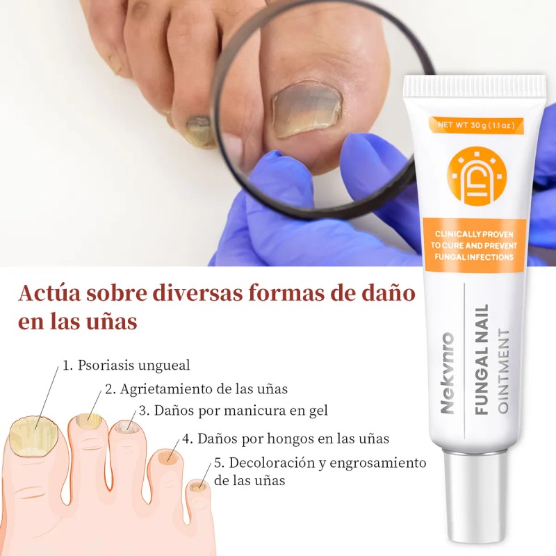 1pc Pomada Antifúngica Para Uñas,tratamiento Contra Hongos