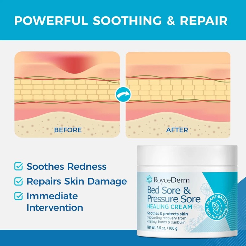 Roycederm Bed & Pressure Sore Healing Cream – Fast Relief