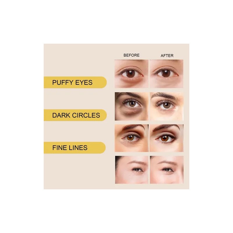 120 Parches Ojos Hialuronico Colágeno Antiojeras Hidratante