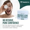 TreeActiv- Tratamiento invisible para el acné quístico con ácido salicílico