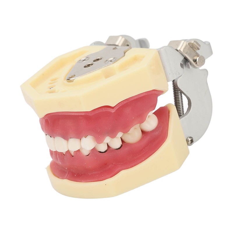 Periodontal Disease Teeth Resin Model Dental Demonstration Teeth Model for