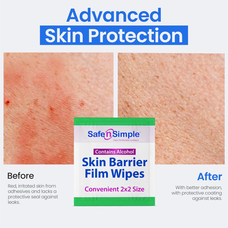 Safe n' Simple Skin Barrier Wipe with Alcohol - 50
