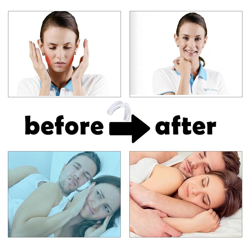 Pack of 4 Grinding Splints for Night, Mouth Guard for