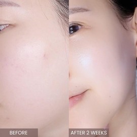 APLIN Pink Tea Tree Daily Toner 150mL/Skin Moisturizer/Facial Moisturizers/5.07 Fl. Oz, CICA, Hyaluronic Acid, Korean Skin Care, Moisturizing, Soothing