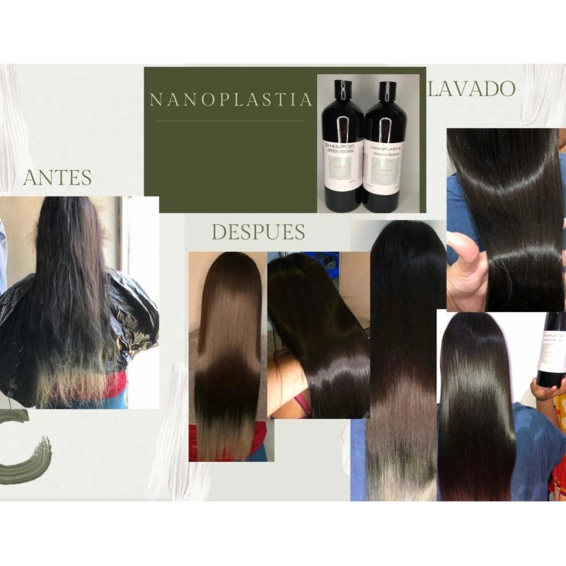 Alaciado Nanoplastia 1 L Kit