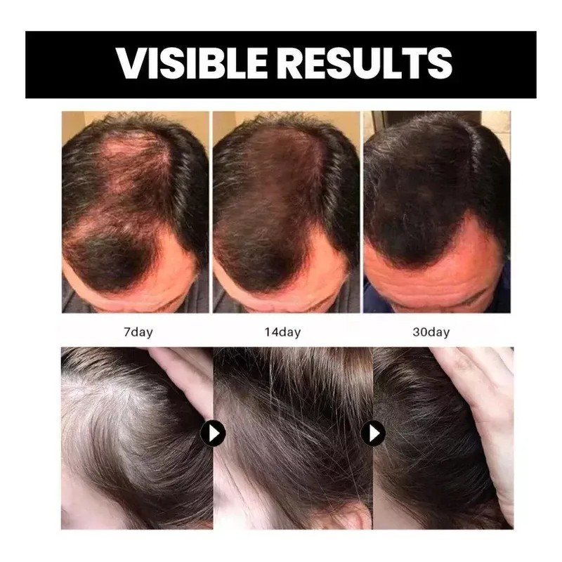 Aceite De Batana De 60ml*3 Para El Crecimiento Del Cabello