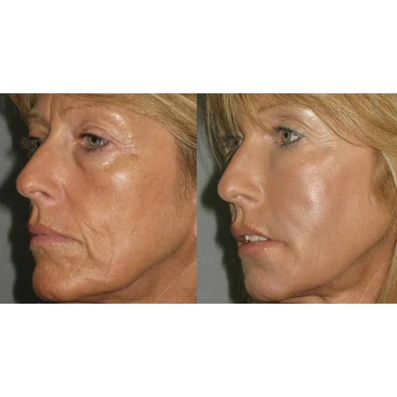 Skindulgence Mascarilla Rejuvenece En 30 Minutos