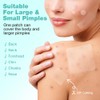 BUTBU 265 Stücks Pickel Patch Groß, 4 Größen Pimple Patches