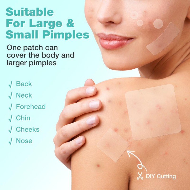 BUTBU 265 Stücks Pickel Patch Groß, 4 Größen Pimple Patches