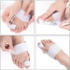 Pedimend Bunion Corrector Relief Orthopedic Splint (1PCS) - Toe Correction