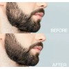 GoldBeards Beard Derma Roller thicker fuller Beard Growth faster beard