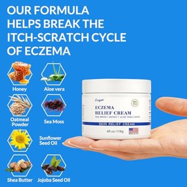 Crema natural calmante para eczema, miel y musgo marino, crema orgánica para aliviar el eczema, para rostro y cuerpo, reparación natural de piel seca 