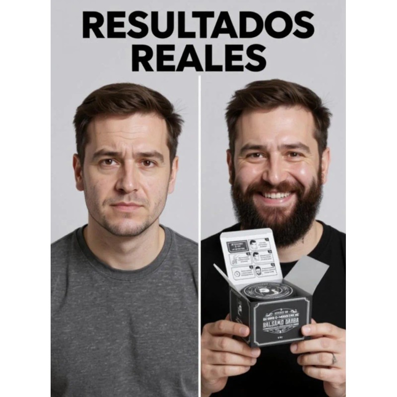Kit 3 Unidades Balsamo Para Crecer La Barba Al 20%