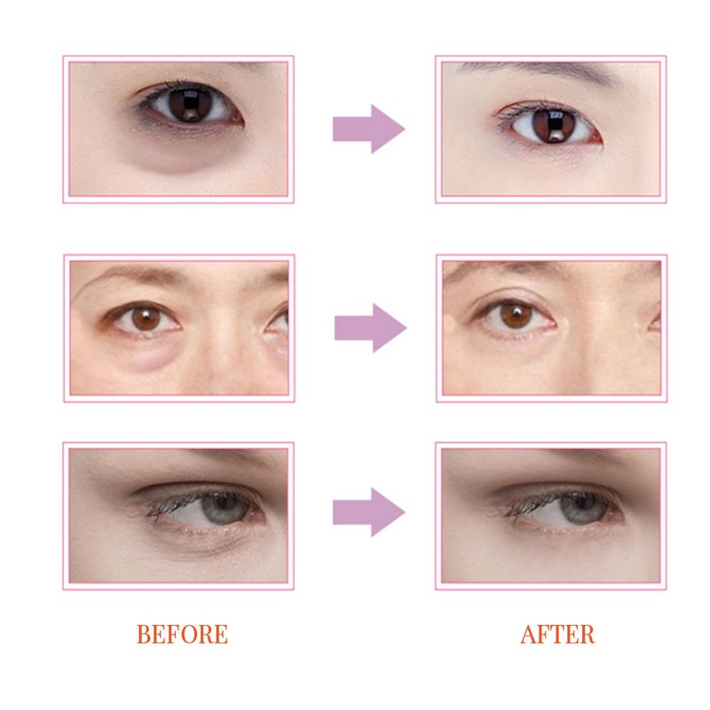 Beauty Eye Firming Cream Essence Elasticidad de retención de humedad
