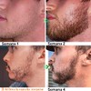 Shoonlo Barba Kit Cuidado, 8 en 1 Kit Barba Hombre