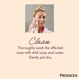 Prosacea Rosacea Treatment Gel, 0.75 Ounce Pack of 5