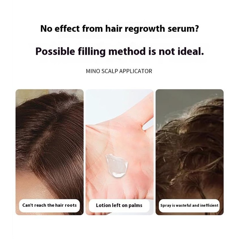 Precision Roller‑Ball Scalp Applicator (5 ml) – Leak‑Proof, Mess‑Free Hair Serum