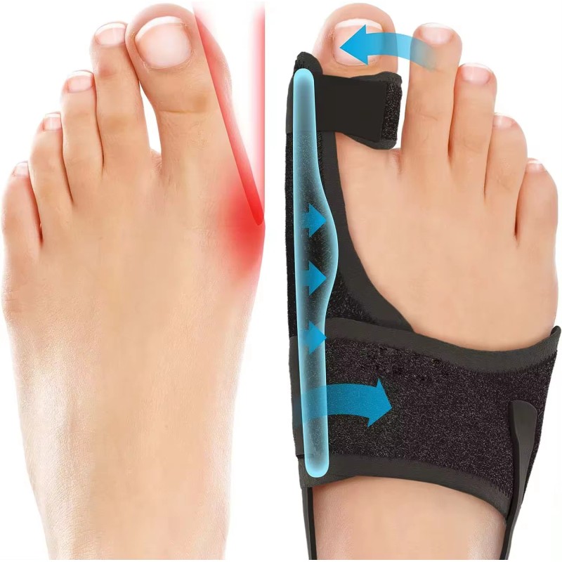 2 Pair Bunion Corrector Fix Hallux Valgus Adjustable Orthosis Women