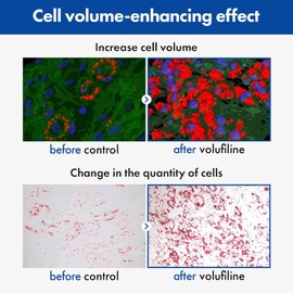 TOSOWOONG Volufiline Serum 11ml – 100% France Sederma Volufiline Concentrate for Plumping, Firming, Glow & Glass Skin – Anti-Aging Serum for Face, Lips, and Body – Deep Hydration & Skin Boost Formula