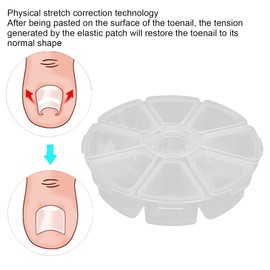 Toenail Correction Stickers, Pack of 120 Ingrown Toenail Smoothing Stains, Foot Care Nail Care Manicure Pedicure Tool, Elastic Patch, Easy to Use