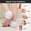 Segbeauty Heel Open Toe Socks, 4 Pairs Gel Heel Socks,