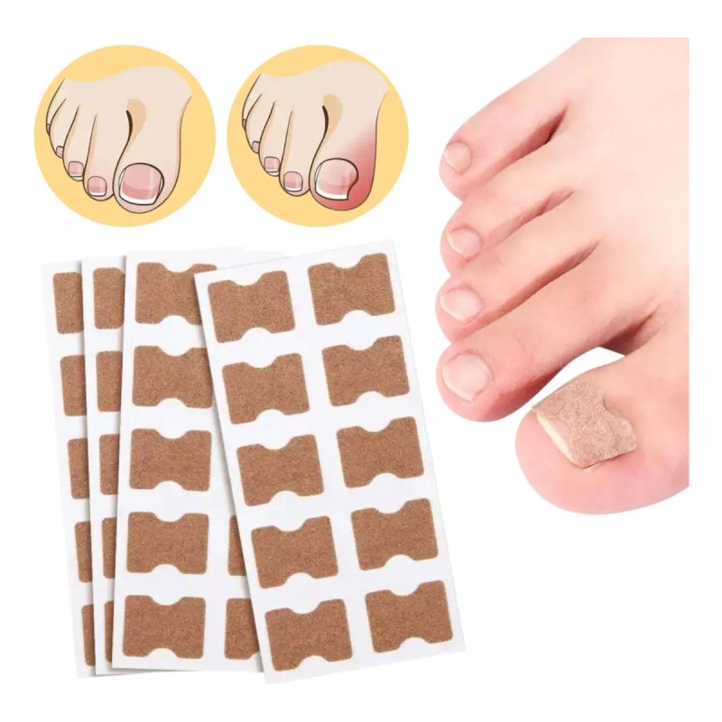 Universo en Linea 50 Parches Correctores Uñas Enterradas Uñeros Adhesivos