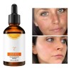 Suero Vitamina C Blanqueador Reparación Cuidado Piel Hidrata