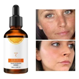 Suero Vitamina C Blanqueador Reparación Cuidado Piel Hidrata