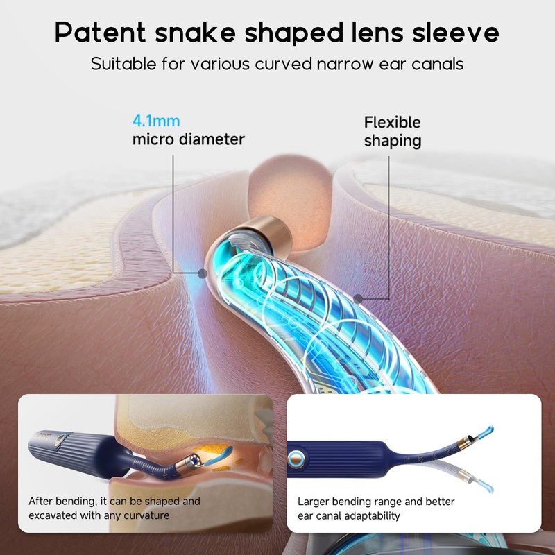 BEBIRD Ear Wax Removal Tool Camera, Visual Earwax Cleaner with