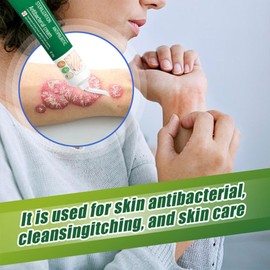 Foot Antibacterial Cream,Athlete's Foot Treatment,FootCream for Very Dry Feet,Deep Moisturising Heel Balm for Callus Remove, Repairing Cracked Heel and Itchy Feet, FootEczema Moisturiser Adults, 1 Pcs