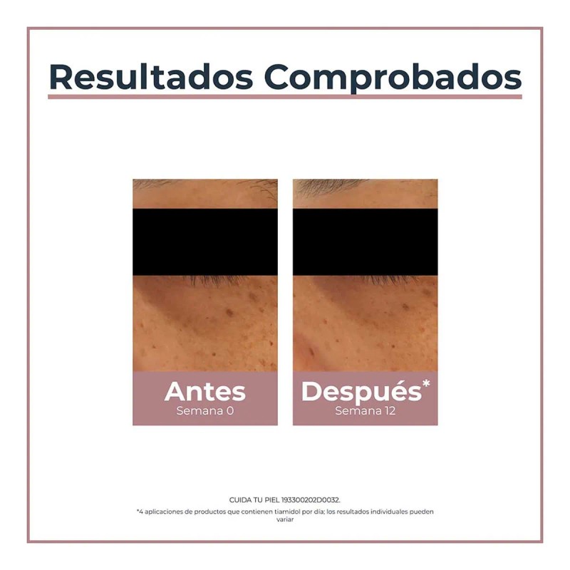 Eucerin Anti-pigment Crema Contorno De Ojos Anti-ojeras 15ml