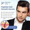 Sérum Para El Crecimiento Del Cabello Con Péptido De Cobre,