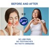 KOHEEL Adaptable Bite Splint Against Bruxism, Crunch Splint for Night,
