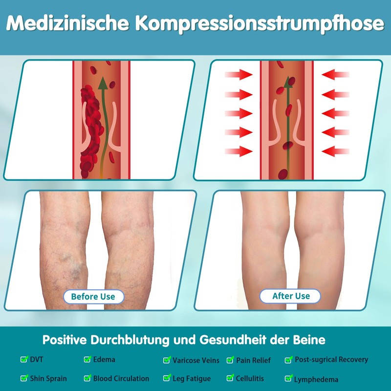 20-30 mmHg Medical Compression Stockings Women's Long Compression Tights Women