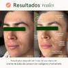 Crema Facial de Baba de Caracol con Colágeno y Hamamelis