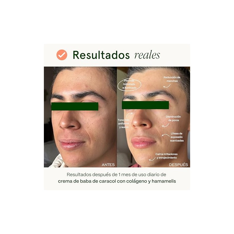 Crema Facial de Baba de Caracol con Colágeno y Hamamelis