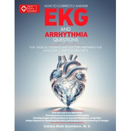 How to Correctly Answer EKG and Arrhythmia Questions: For Medical Students and Doctors Preparing for USMLE Step 1, Step 2 CK, and Step 3