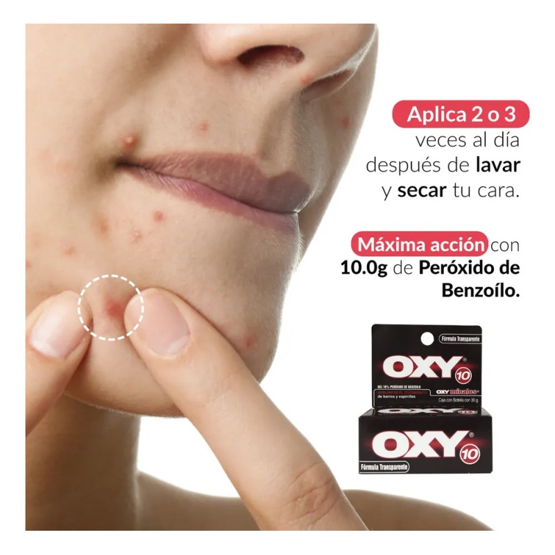 Oxy 10 Gel Antiacné 30g con Peróxido de Benzoílo Rohto