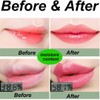 Aloe Vera Lipstick, Aloe Vera Lip Balm, Moisturizing Crystal Jelly