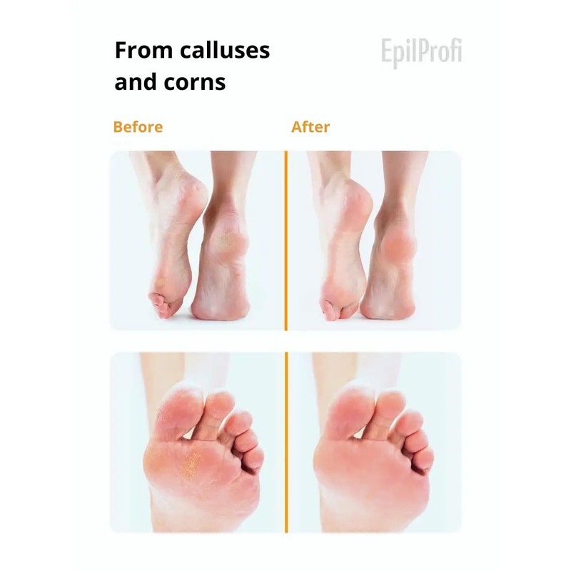 EpilProfi Vosk Crack Wax Professional Deep Moisturizer Cream for Dry