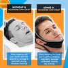 Acusnore Stop Snoring Anti Snore Jaw Chin Strap Belt Apnea