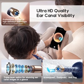 BEBIRD Ear Wax Removal Tool Camera, Visual Earwax Cleaner with Cleaning Kit as Spade/Spoon/Pick/Tweezer Clean Ears for Family, Ear-Scope Otoscope Wireless WiFi Connect