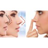 Rhinoplasty 7 Pzs Corrector Nasal Invisible Perfila Nariz Al Instante!