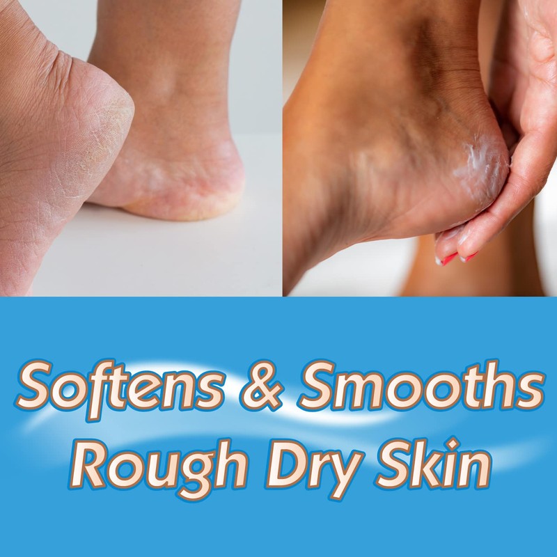 Masterplast Heel Balm, Soften for Relief & Comfort, Ready to