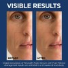 L'oreal Paris Revitalift Suero Nocturno De Retinol 0.3 % reduce