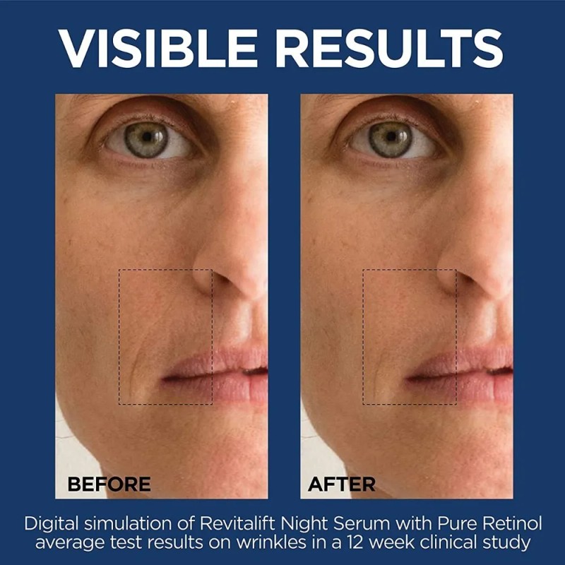 L'oreal Paris Revitalift Suero Nocturno De Retinol 0.3 % reduce