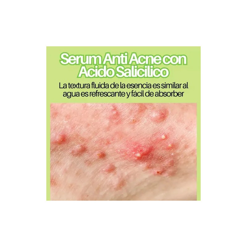 Serums Faciales + Rodillo Gua Sha Jade Masaje Paquete 5pzs
