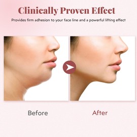 Reusable V-Line Mask, Chin Strap For Sleeping【Lifting Effect】【Adjustable】【Easy To Use】, Jawline Shaper Face Strap4