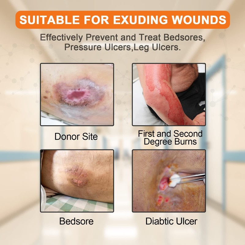 Carbou Wound Dressing Sacrum Silicone Foam Dressing, 6''x7''(15cm x18cm) Bordered